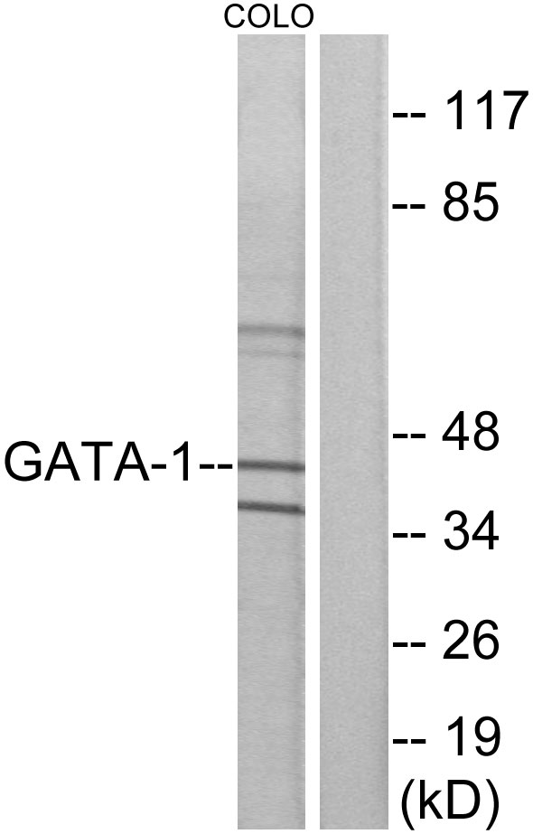 GATA1 Antibody - Western blot analysis of lysates from COLO cells, using GATA1 Antibody. The lane on the right is blocked with the synthesized peptide.