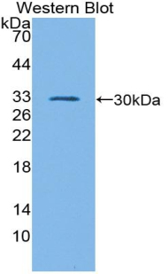 GATA1 Antibody - Western blot of recombinant GATA1.