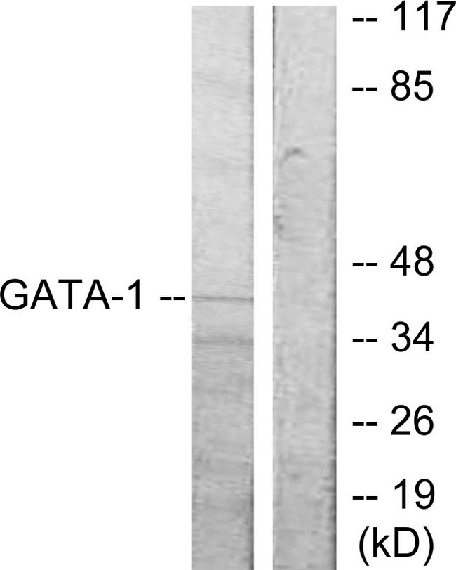GATA1 Antibody - Western blot analysis of lysates from COS7 cells, using GATA1 Antibody. The lane on the right is blocked with the synthesized peptide.