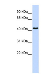 GATA1 Antibody - GATA1 antibody Western blot of MCF7 cell lysate. This image was taken for the unconjugated form of this product. Other forms have not been tested.