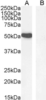 GATA1 Antibody - Goat Anti-GATA1 Antibody (1µg/ml) staining of K562 nuclear cell lysate (A) and negative control Human Hippocampus (B) lysate (35µg protein in RIPA buffer). Detected by chemiluminescencence.