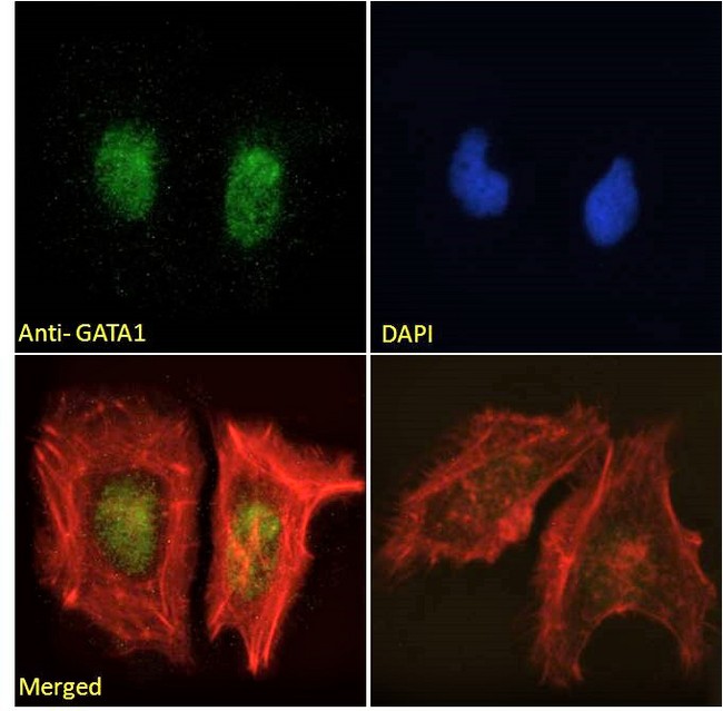GATA1 Antibody - Goat Anti-GATA1 Antibody Immunofluorescence analysis of paraformaldehyde fixed HeLa cells, permeabilized with 0.15% Triton. Primary incubation 1hr (10ug/ml) followed by Alexa Fluor 488 secondary antibody (2ug/ml), showing nuclear staining. Actin filaments were stained with phalloidin (red) and the nuclear stain is DAPI (blue). Negative control: Unimmunized goat IgG (10ug/ml) followed by Alexa Fluor 488 secondary antibody (2ug/ml).