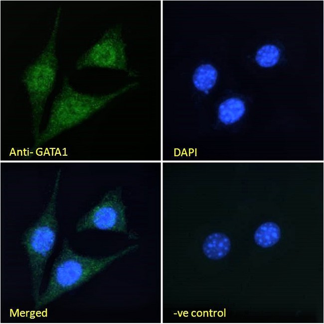 GATA1 Antibody - Goat Anti-GATA1 Antibody Immunofluorescence analysis of paraformaldehyde fixed NIH3T3 cells, permeabilized with 0.15% Triton. Primary incubation 1hr (10ug/ml) followed by Alexa Fluor 488 secondary antibody (2ug/ml), showing nuclear staining. The nuclear stain is DAPI (blue). Negative control: Unimmunized goat IgG (10ug/ml) followed by Alexa Fluor 488 secondary antibody (2ug/ml).