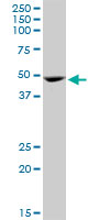 GATA1 Antibody - GATA1 monoclonal antibody (M06), clone 3G6. Western Blot analysis of GATA1 expression in Jurkat.