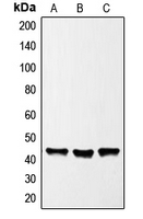 GATA1 Antibody - Western blot analysis of GATA1 expression in HeLa (A); K562 (B); NIH3T3 (C) whole cell lysates.