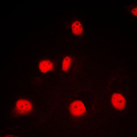 GATA1 Antibody - Immunofluorescent analysis of GATA1 staining in K562 cells. Formalin-fixed cells were permeabilized with 0.1% Triton X-100 in TBS for 5-10 minutes and blocked with 3% BSA-PBS for 30 minutes at room temperature. Cells were probed with the primary antibody in 3% BSA-PBS and incubated overnight at 4 C in a humidified chamber. Cells were washed with PBST and incubated with a DyLight 594-conjugated secondary antibody (red) in PBS at room temperature in the dark. DAPI was used to stain the cell nuclei (blue).