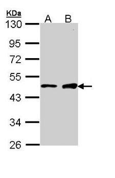 GATA1 Antibody - Sample (30 ug of whole cell lysate). A: A431. B: H1299. 10% SDS PAGE. GATA1 antibody diluted at 1:1000. 
