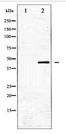 GATA1 Antibody - Western blot of GATA1 expression in K562 whole cell lysates,The lane on the left is treated with the antigen-specific peptide.