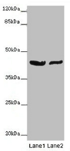 GATA1 Antibody - Western blot All Lanes: GATA1 antibody at 7 ug/ml Lane 1: MCF7 whole cell lysate Lane 2: A549 whole cell lysate Secondary Goat polyclonal to rabbit IgG at 1/10000 dilution Predicted band size: 43,36,35 kDa Observed band size: 43 kDa