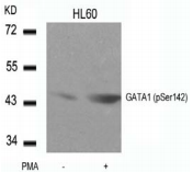 GATA1 Antibody - Detection of GATA1 (phospho-Ser142) in extracts of HL60 cells untreated or treated with PMA.