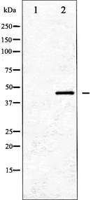GATA1 Antibody - Western blot analysis of GATA1 expression in K562 whole cells lysates. The lane on the left is treated with the antigen-specific peptide.