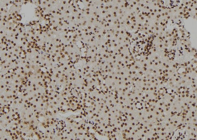 GATA1 Antibody - 1:100 staining rat kidney tissue by IHC-P. The sample was formaldehyde fixed and a heat mediated antigen retrieval step in citrate buffer was performed. The sample was then blocked and incubated with the antibody for 1.5 hours at 22°C. An HRP conjugated goat anti-rabbit antibody was used as the secondary.
