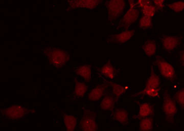 GATA1 Antibody - Staining HeLa cells by IF/ICC. The samples were fixed with PFA and permeabilized in 0.1% Triton X-100, then blocked in 10% serum for 45 min at 25°C. The primary antibody was diluted at 1:200 and incubated with the sample for 1 hour at 37°C. An Alexa Fluor 594 conjugated goat anti-rabbit IgG (H+L) Ab, diluted at 1/600, was used as the secondary antibody.