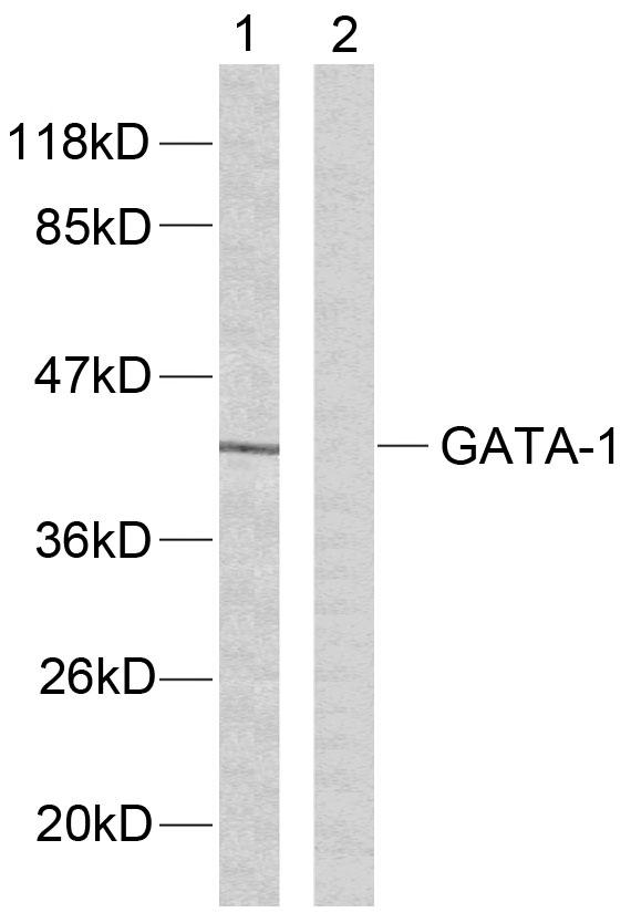 GATA1 Antibody - Western blot analysis of extracts from K562 cells using GATA-1 (Ab-142) antibody.