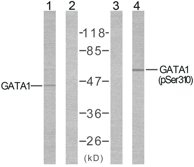 GATA1 Antibody - Western blot analysis using GATA1(Ab-310) Antibody (  and GATA1(Phospho-Ser310) Antibody: Line1: The extracts from COS7 cells using  Line2: The extracts from COS7 cells using preincubated with synthesized peptide.