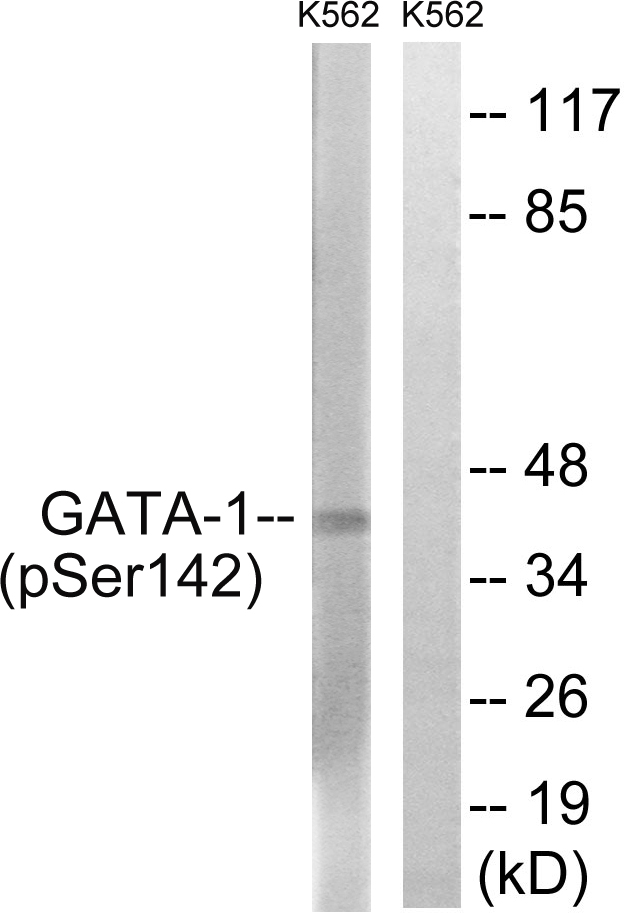 GATA1 Antibody - Western blot analysis of lysates from K562 cells, using GATA1 (Phospho-Ser142) Antibody. The lane on the right is blocked with the phospho peptide.