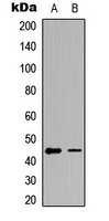 GATA1 Antibody - Western blot analysis of GATA1 (pS142) expression in HeLa (A); HEK293T (B) whole cell lysates.