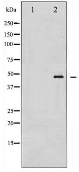 GATA1 Antibody - Western blot of GATA1 phosphorylation expression in K562 whole cell lysates,The lane on the left is treated with the antigen-specific peptide.