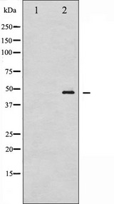 GATA1 Antibody - Western blot analysis of GATA1 phosphorylation expression in K562 whole cells lysates. The lane on the left is treated with the antigen-specific peptide.