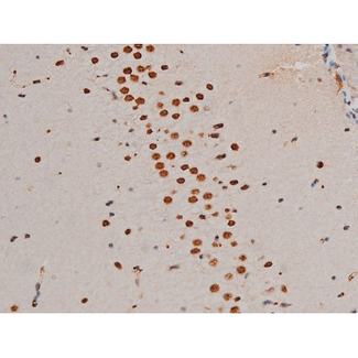 GATA1 Antibody - 1:200 staining mouse brain tissue by IHC-P. The tissue was formaldehyde fixed and a heat mediated antigen retrieval step in citrate buffer was performed. The tissue was then blocked and incubated with the antibody for 1.5 hours at 22°C. An HRP conjugated goat anti-rabbit antibody was used as the secondary.