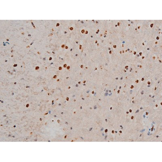 GATA1 Antibody - 1:200 staining mouse brain tissue by IHC-P. The tissue was formaldehyde fixed and a heat mediated antigen retrieval step in citrate buffer was performed. The tissue was then blocked and incubated with the antibody for 1.5 hours at 22°C. An HRP conjugated goat anti-rabbit antibody was used as the secondary.