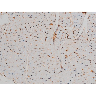 GATA1 Antibody - 1:200 staining mouse heart tissue by IHC-P. The tissue was formaldehyde fixed and a heat mediated antigen retrieval step in citrate buffer was performed. The tissue was then blocked and incubated with the antibody for 1.5 hours at 22°C. An HRP conjugated goat anti-rabbit antibody was used as the secondary.