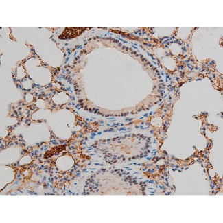 GATA1 Antibody - 1:200 staining mouse lung tissue by IHC-P. The tissue was formaldehyde fixed and a heat mediated antigen retrieval step in citrate buffer was performed. The tissue was then blocked and incubated with the antibody for 1.5 hours at 22°C. An HRP conjugated goat anti-rabbit antibody was used as the secondary.
