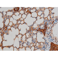GATA1 Antibody - 1:200 staining mouse lung tissue by IHC-P. The tissue was formaldehyde fixed and a heat mediated antigen retrieval step in citrate buffer was performed. The tissue was then blocked and incubated with the antibody for 1.5 hours at 22°C. An HRP conjugated goat anti-rabbit antibody was used as the secondary.