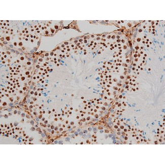 GATA1 Antibody - 1:200 staining mouse testis tissue by IHC-P. The tissue was formaldehyde fixed and a heat mediated antigen retrieval step in citrate buffer was performed. The tissue was then blocked and incubated with the antibody for 1.5 hours at 22°C. An HRP conjugated goat anti-rabbit antibody was used as the secondary.
