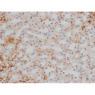 GATA1 Antibody - 1:200 staining rat kidney tissue by IHC-P. The tissue was formaldehyde fixed and a heat mediated antigen retrieval step in citrate buffer was performed. The tissue was then blocked and incubated with the antibody for 1.5 hours at 22°C. An HRP conjugated goat anti-rabbit antibody was used as the secondary.