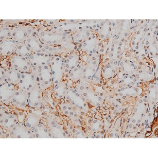 GATA1 Antibody - 1:200 staining rat kidney tissue by IHC-P. The tissue was formaldehyde fixed and a heat mediated antigen retrieval step in citrate buffer was performed. The tissue was then blocked and incubated with the antibody for 1.5 hours at 22°C. An HRP conjugated goat anti-rabbit antibody was used as the secondary.