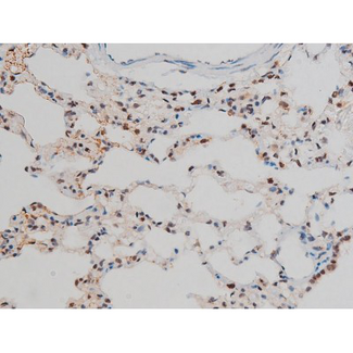 GATA1 Antibody - 1:200 staining rat lung tissue by IHC-P. The tissue was formaldehyde fixed and a heat mediated antigen retrieval step in citrate buffer was performed. The tissue was then blocked and incubated with the antibody for 1.5 hours at 22°C. An HRP conjugated goat anti-rabbit antibody was used as the secondary.