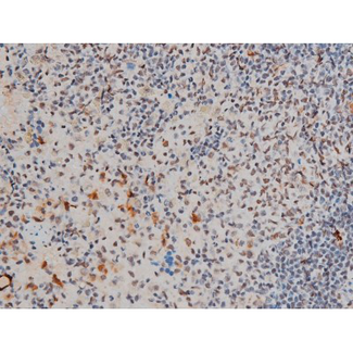 GATA1 Antibody - 1:200 staining rat spleen tissue by IHC-P. The tissue was formaldehyde fixed and a heat mediated antigen retrieval step in citrate buffer was performed. The tissue was then blocked and incubated with the antibody for 1.5 hours at 22°C. An HRP conjugated goat anti-rabbit antibody was used as the secondary.