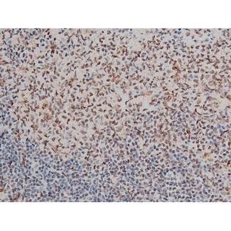 GATA1 Antibody - 1:200 staining rat spleen tissue by IHC-P. The tissue was formaldehyde fixed and a heat mediated antigen retrieval step in citrate buffer was performed. The tissue was then blocked and incubated with the antibody for 1.5 hours at 22°C. An HRP conjugated goat anti-rabbit antibody was used as the secondary.