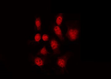 GATA1 Antibody - Staining K562 cells by IF/ICC. The samples were fixed with PFA and permeabilized in 0.1% Triton X-100, then blocked in 10% serum for 45 min at 25°C. The primary antibody was diluted at 1:200 and incubated with the sample for 1 hour at 37°C. An Alexa Fluor 594 conjugated goat anti-rabbit IgG (H+L) Ab, diluted at 1/600, was used as the secondary antibody.