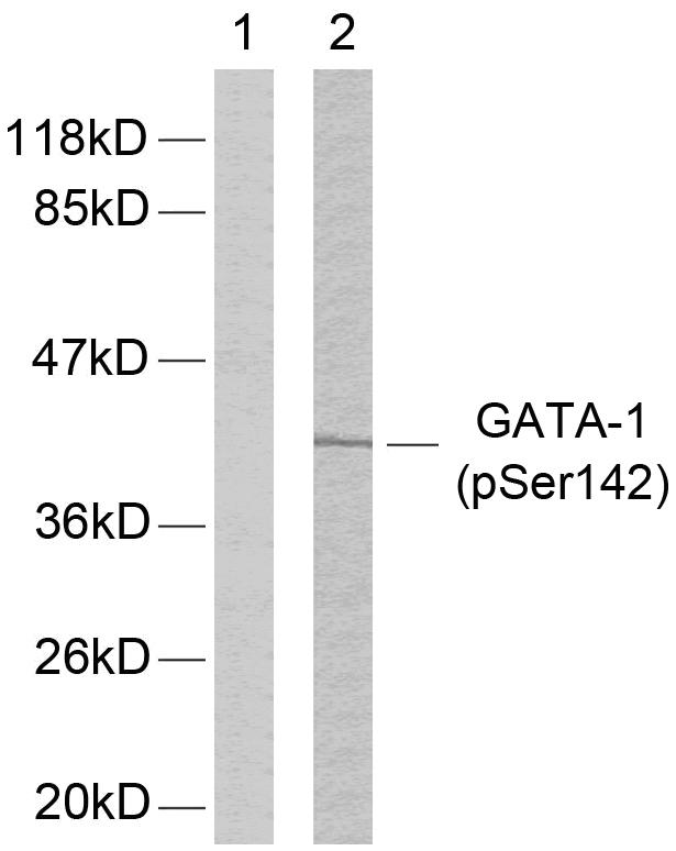 GATA1 Antibody - Western blot analysis of extracts from K562 cells using GATA-1 (phospho-Ser142) antibody.