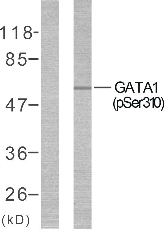 GATA1 Antibody - Western blot analysis of lysates from COS7 cells treated with EPO, using GATA1 (Phospho-Ser310) Antibody. The lane on the left is blocked with the phospho peptide.