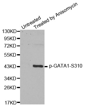 GATA1 Antibody - Western blot analysis of extracts from HT29 cells.