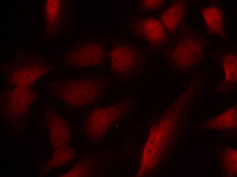 GATA1 Antibody - Immunofluorescence staining of methanol-fixed Hela cells.
