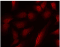 GATA1 Antibody - Immunofluorescence staining of methanol fixed HeLa cells using Rabbit Anti GATA1 (Phospho-Ser310) pAb(Rabbit Anti-GATA1 (Phospho-Ser310) Polyclonal Antibody,Red)