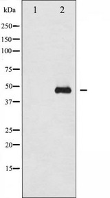 GATA1 Antibody - Western blot analysis of GATA1 phosphorylation expression in EPO treated COS7 whole cells lysates. The lane on the left is treated with the antigen-specific peptide.