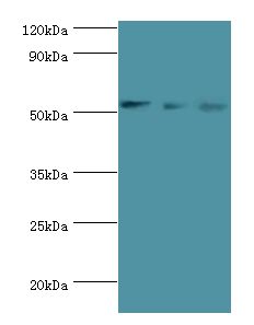 GATA2 Antibody - Western blot. All lanes: Endothelial transcription factor GATA-2 antibody at 3 ug/ml. Lane 1: HeLa whole cell lysate. Lane 2: K562 whole cell lysate. Lane 3: mouse heart tissue. Secondary antibody: Goat polyclonal to rabbit at 1:10000 dilution. Predicted band size: 51 kDa. Observed band size: 51 kDa.