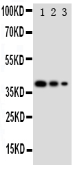 GATA2 Antibody - Anti-GATA2 antibody, Western blottingRecombinant Protein Detection Source: E. coli derived -recombinant Human GATA2, 38. 3KD (162aa tag+ M1-G200)Lane 1: Recombinant Human GATA2 Protein 10ng Lane 2: Recombinant Human GATA2 Protein 5ng Lane 3: Recombinant Human GATA2 Protein 2. 5ng