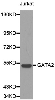 GATA2 Antibody - Western blot analysis of Jurkat cell lysate using GATA2 antibody.