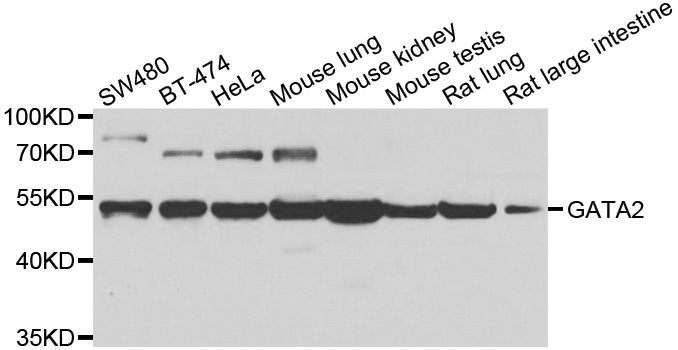 GATA2 Antibody - Western blot analysis of extracts of various cell lines, using GATA2 antibody at 1:1000 dilution. The secondary antibody used was an HRP Goat Anti-Rabbit IgG (H+L) at 1:10000 dilution. Lysates were loaded 25ug per lane and 3% nonfat dry milk in TBST was used for blocking. An ECL Kit was used for detection and the exposure time was 30s.
