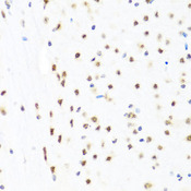 GATA2 Antibody - Immunohistochemistry of paraffin-embedded mouse brain using GATA2 antibodyat dilution of 1:100 (40x lens).