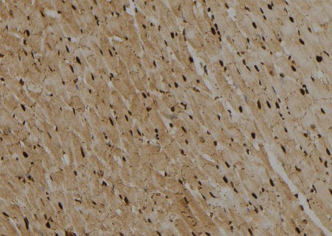 GATA2 Antibody - 1:100 staining rat heart tissue by IHC-P. The sample was formaldehyde fixed and a heat mediated antigen retrieval step in citrate buffer was performed. The sample was then blocked and incubated with the antibody for 1.5 hours at 22°C. An HRP conjugated goat anti-rabbit antibody was used as the secondary.