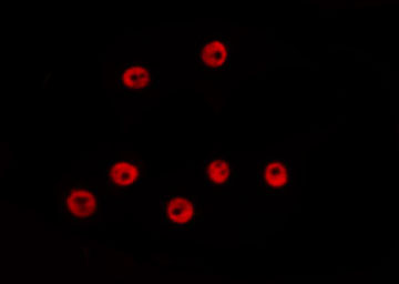GATA2 Antibody - Staining HepG2 cells by IF/ICC. The samples were fixed with PFA and permeabilized in 0.1% Triton X-100, then blocked in 10% serum for 45 min at 25°C. The primary antibody was diluted at 1:200 and incubated with the sample for 1 hour at 37°C. An Alexa Fluor 594 conjugated goat anti-rabbit IgG (H+L) Ab, diluted at 1/600, was used as the secondary antibody.