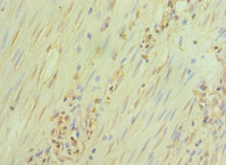 GATA3 Antibody - Immunohistochemistry of paraffin-embedded human epityphlon tissue using GATA3 Antibody at dilution of 1:100