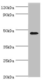 GATA3 Antibody - Western blot All lanes: GATA3 antibody at 6µg/ml + MCF-7 whole cell lysate Secondary Goat polyclonal to rabbit IgG at 1/10000 dilution Predicted band size: 48, 49 kDa Observed band size: 48 kDa